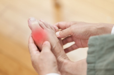 Key Strategies for Preventing Gout