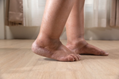 What Causes Swollen Feet and Ankles?